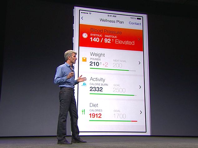 แม่นไหมแม่น WSJ แฉ Apple iWatch มีมากกว่าหนึ่งรุ่น เซ็นเซอร์อีกนับ 10!!