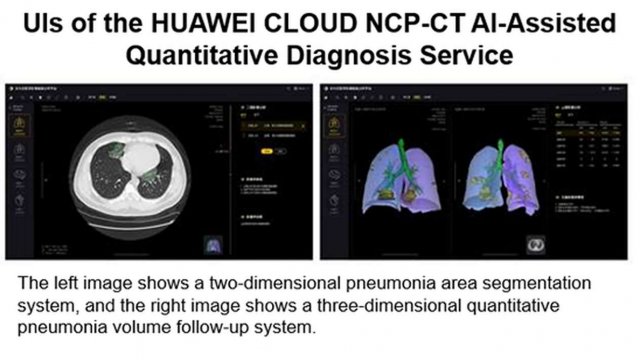 HUAWEI CLOUD เปิดตัวอุปกรณ์ผู้ช่วย AI วิเคราะห์ COVID-19 ทราบผลแบบ CT Quantification ภายในไม่กี่วินาที