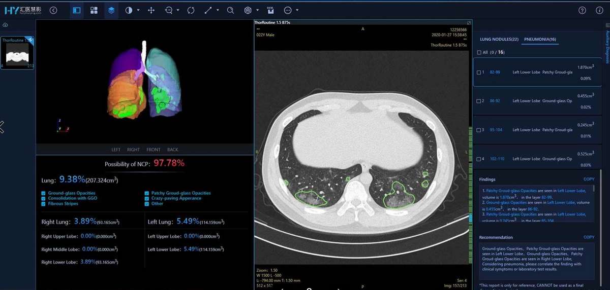 Huawei AI Assisted Technology Services Help Combat COVID-19 in Asia Pacific