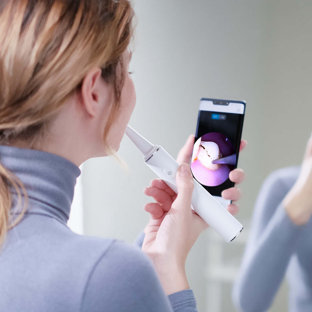 เครื่องขูดหินปูน Xiaomi