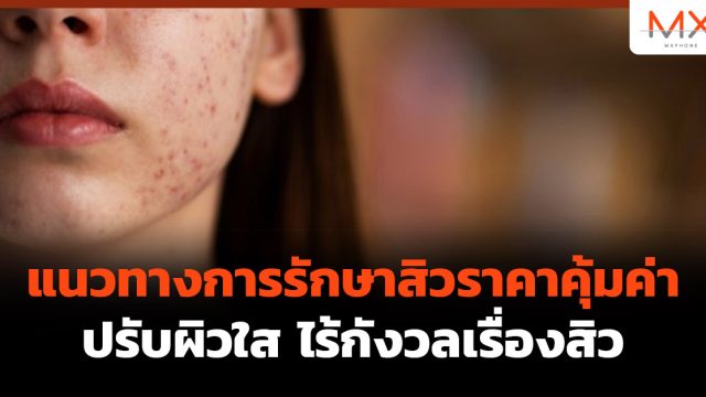 แนวทางการ รักษาสิวราคา คุ้มค่า: ปรับผิวใส ไร้กังวลเรื่องสิว