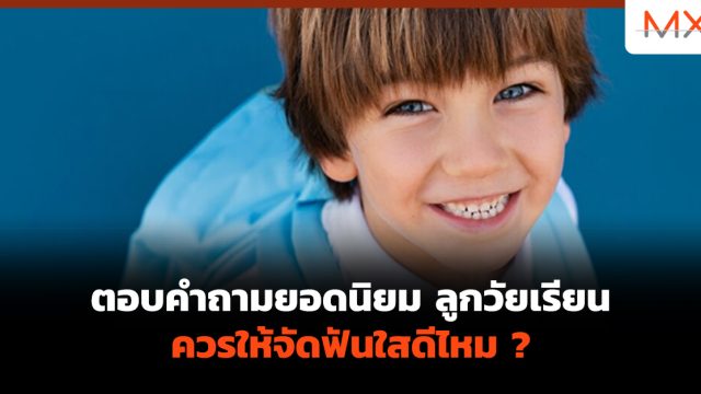 ตอบคำถามยอดนิยม ลูกวัยเรียน ควรให้จัดฟันใสดีไหม ?