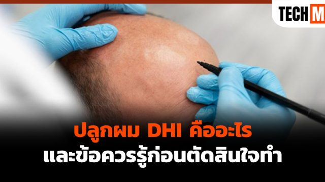 ปลูกผม DHI คืออะไร และข้อควรรู้ก่อนตัดสินใจทำ