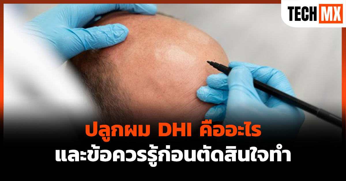 ปลูกผม DHI