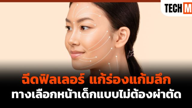 ฉีดฟิลเลอร์ แก้ร่องแก้มลึก ทางเลือกหน้าเด็กแบบไม่ต้องผ่าตัด