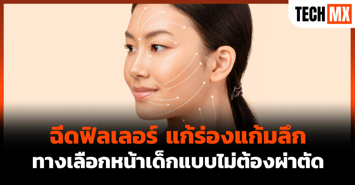ฉีดฟิลเลอร์ แก้ร่องแก้มลึก