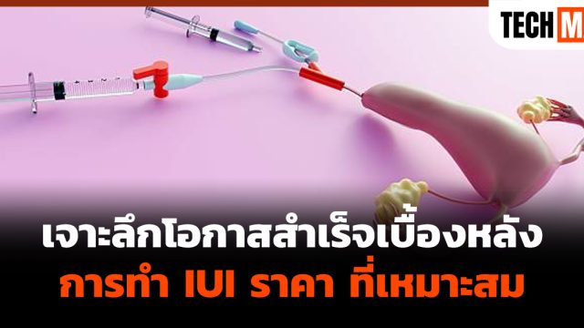 เจาะลึกโอกาสสำเร็จเบื้องหลัง การทำ IUI ราคา ที่เหมาะสม