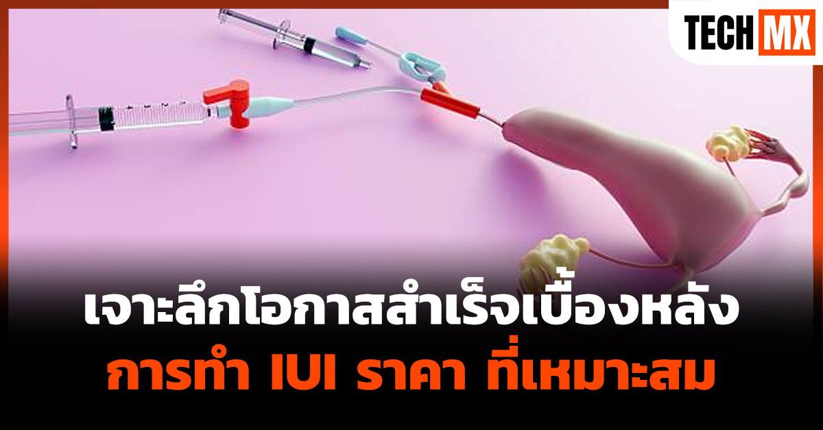 การทำ IUI ราคา