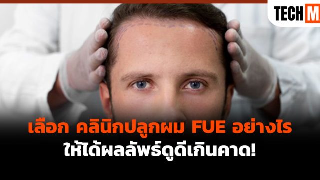 เลือก คลินิกปลูกผม FUE อย่างไร ให้ได้ผลลัพธ์ดูดีเกินคาด!