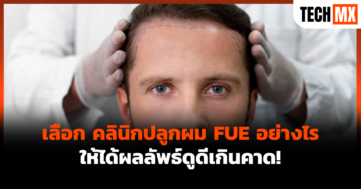 คลินิกปลูกผม
