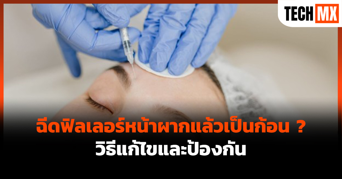 ฉีดฟิลเลอร์หน้าผาก