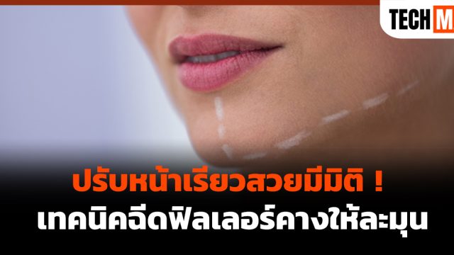ปรับหน้าเรียวสวยมีมิติ ! เทคนิคฉีดฟิลเลอร์คางให้ละมุน